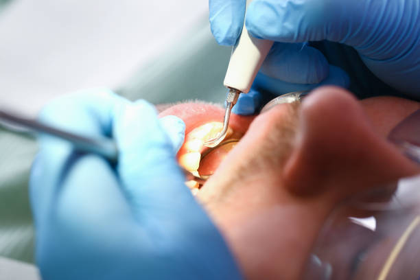 Best Weekend Emergency Dentist in Henderson, NC